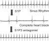 Bitopic Sphingosine 1-Phosphate Receptor 3 (S1P3) Antagonist Rescue from Complete Heart Block: Pharmacological and Genetic Evidence for Direct S1P3 Regulation of Mouse Cardiac Conduction